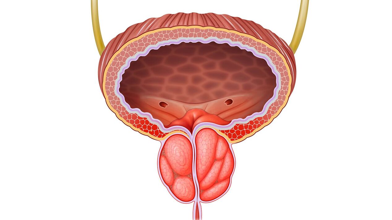 zanícená prostata